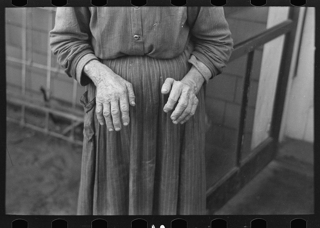 The hands of Mrs. Andrew Ostermeyer, wife of a homesteader, Woodbury County, Iowa, 1936 — Russell Lee, FSA/LOC